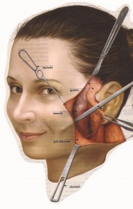 Esquema lifting facial fazendo close